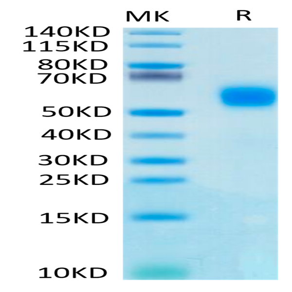 Human IL-1R2/IL-1 RII/CD121b Protein (IL1-HM1R2)