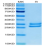 Human IL-15RA&IL-15 Protein (IL1-HM1R5)