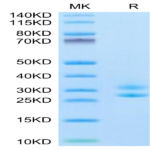 Biotinylated Human IL-15RA&IL-15 Protein (Primary Amine Labeling) (IL1-HM1R5B)