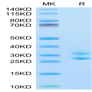 Biotinylated Human IL-15RA&IL-15 Protein (Primary Amine Labeling) (IL1-HM1R5B)