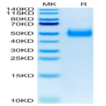 Human IL-17RB Protein (IL1-HM1RB)