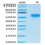 Human IL-13 Protein (IL1-HM213)