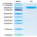 Human IL-1 Rrp2/IL-1 R6 Protein (IL1-HM2L2)