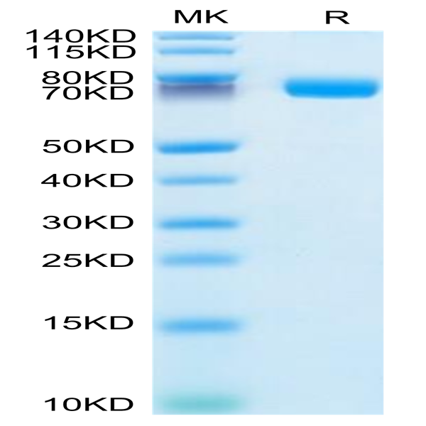 Human IL-1R2/IL-1 RII/CD121b Protein (IL1-HM2R2)