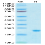 Human IL-10 Protein (IL1-HM410)