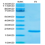 Biotinylated Human IL-10 Protein (IL1-HM410B)
