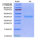 Human IL-12 Protein (IL1-HM412)