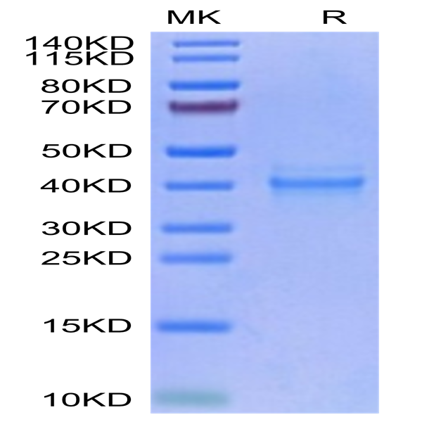 Human IL-12 Protein (IL1-HM412)