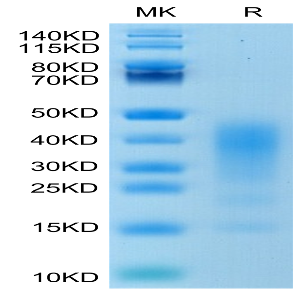 Human IL-13 Protein (IL1-HM413)