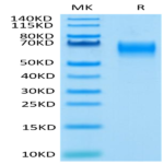 Human IL-1 Rrp2/IL-1 R6 Protein (IL1-HM4L2)