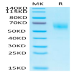 Biotinylated Human IL-1 Rrp2/IL-1 R6 Protein (IL1-HM4L2B)