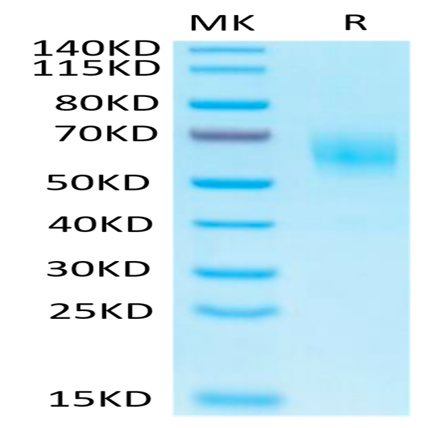 Biotinylated Human IL-1 Rrp2/IL-1 R6 Protein (IL1-HM4L2B)
