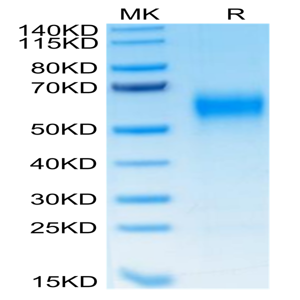 Human IL-1R3/IL-1 RAcP Protein (IL1-HM4R3)