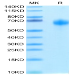 Biotinylated Human IL-1R3/IL-1 RAcP Protein (IL1-HM4R3B)