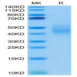 Human IL-10 R alpha Protein (IL1-HM4RA)