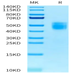 Biotinylated Human IL-10 R alpha Protein (IL1-HM4RAB)