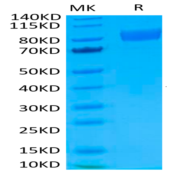 Biotinylated Human IL-17R alpha/CD217 Protein (IL1-HM5RAB)