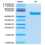 Mouse IL-1R3/IL-1 RAcP Protein (IL1-MM1R3)