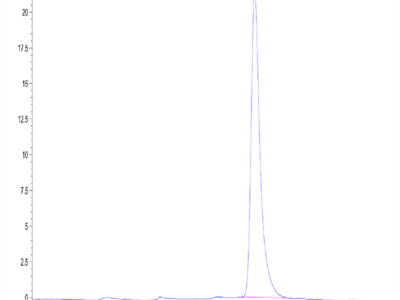 Mouse IL-17RB Protein (IL1-MM1RB)