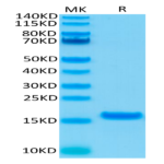 Human IL-21 Protein (IL2-HE021)