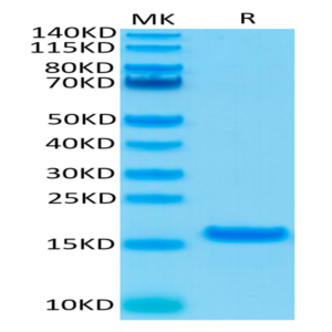 Human IL-21 Protein (IL2-HE021)