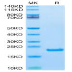 Biotinylated Human IL-21 Protein (IL2-HE421B)