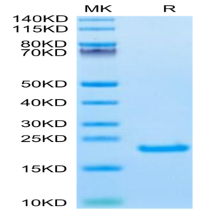Biotinylated Human IL-21 Protein (IL2-HE421B)