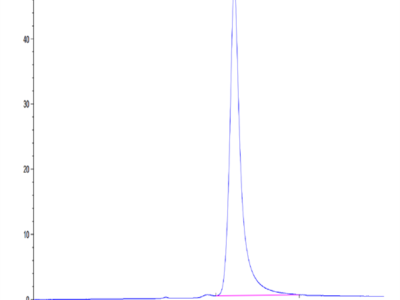 Human IL-20 Protein (IL2-HM120)