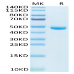 Human IL-20 Protein (IL2-HM120)