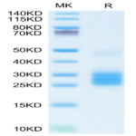 Human IL-25/IL-17E Protein (IL2-HM125)