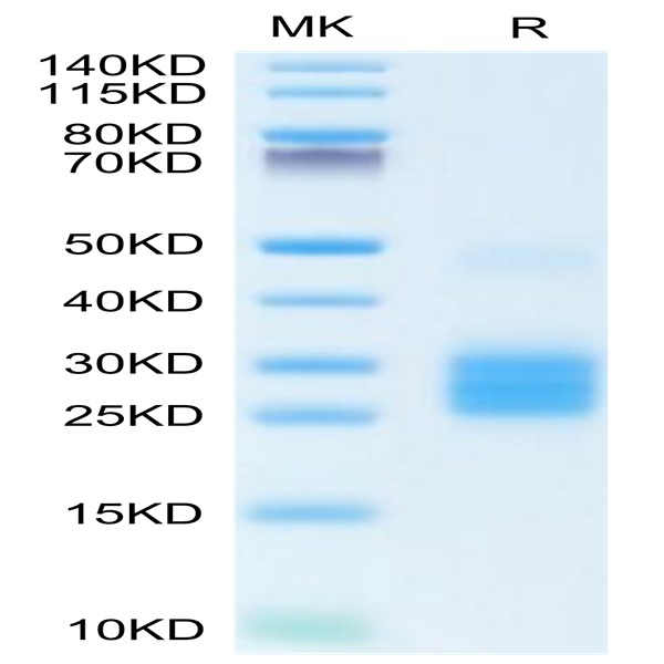 Human IL-25/IL-17E Protein (IL2-HM125)