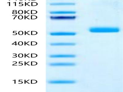 Human IL-23 P19/IL-23A Protein (IL2-HM219)