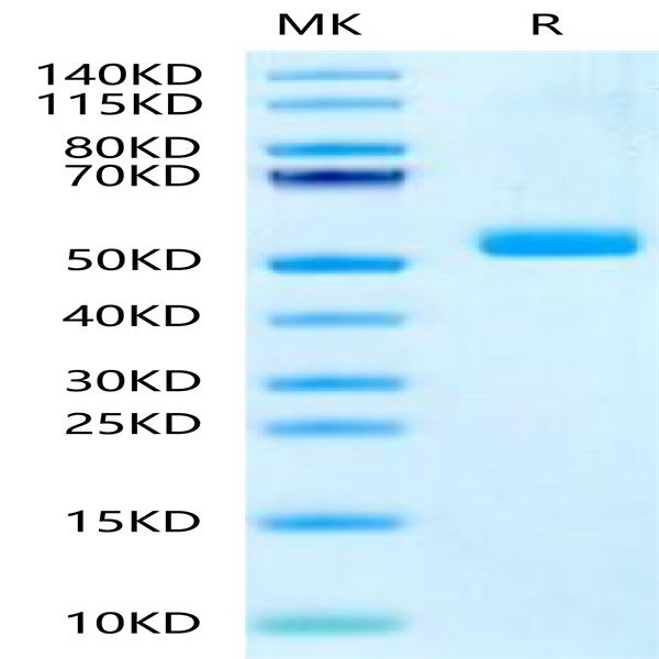 Human IL-23 P19/IL-23A Protein (IL2-HM219) Human IL-23 P19/IL-23A Protein (IL2-HM219)