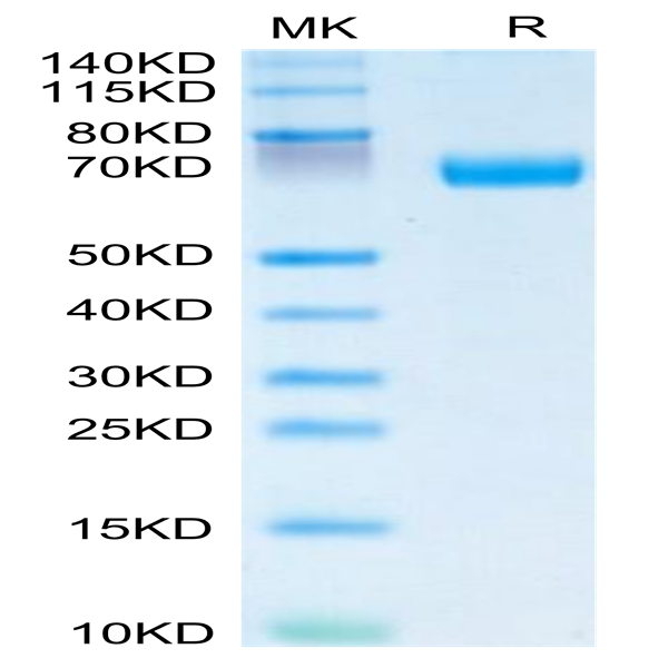 Human IL-20RA Protein (IL2-HM2RA)