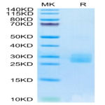 Biotinylated Human IL-25/IL-17E Protein (IL2-HM425B)
