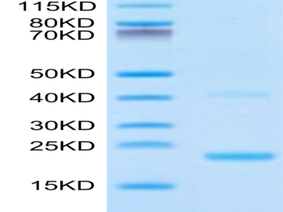 Biotinylated Mouse IL-21 Protein (IL2-ME421B)