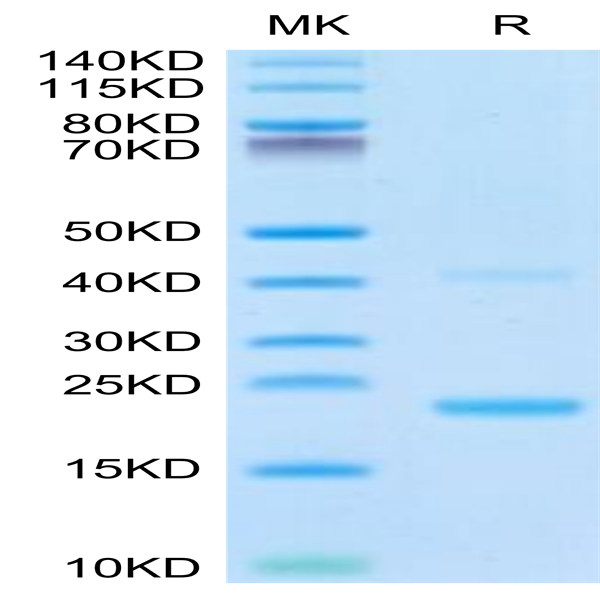 Biotinylated Mouse IL-21 Protein (IL2-ME421B) Biotinylated Mouse IL-21 Protein (IL2-ME421B)