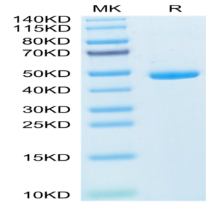 Mouse IL-20 Protein (IL2-MM120)