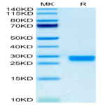 Biotinylated Mouse IL-2 Protein (IL2-MM401B)