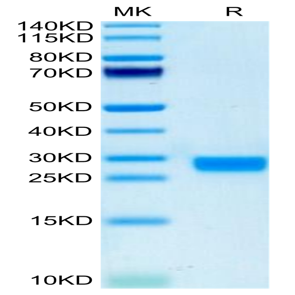 Biotinylated Mouse IL-2 Protein (IL2-MM401B)
