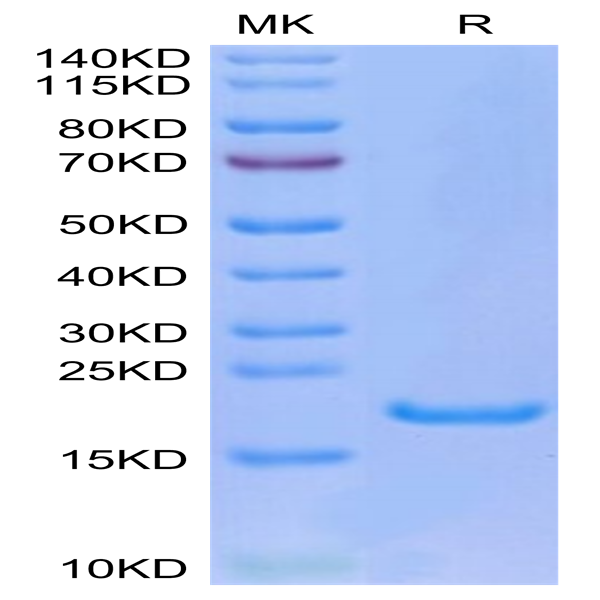 Human IL-33 Protein (IL3-HE001)