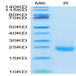 Human IL-31 Protein (IL3-HM101)