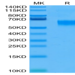 Human IL-3 R alpha/CD123 Protein (IL3-HM1RA)
