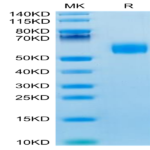 Mouse IL-3 Protein (IL3-MM201)