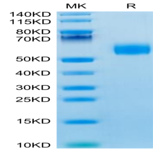Mouse IL-3 Protein (IL3-MM201)