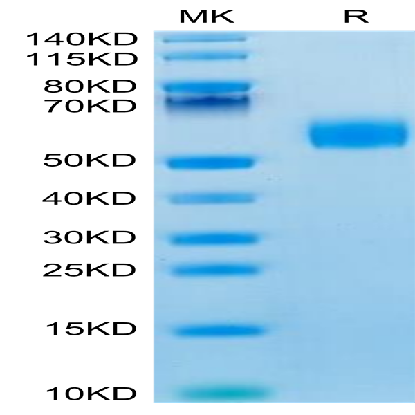 Mouse IL-3 Protein (IL3-MM201)