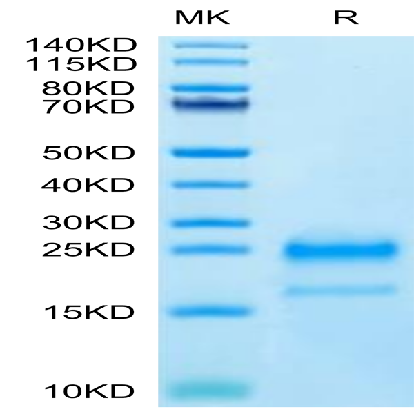 Cynomolgus IL-4 Protein (IL4-CM101)
