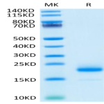 Human IL-4 Protein (IL4-HM001)