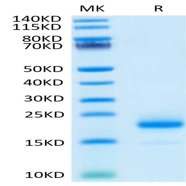 Human IL-4 Protein (IL4-HM001)