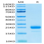 Human IL-4 Protein (IL4-HM401)